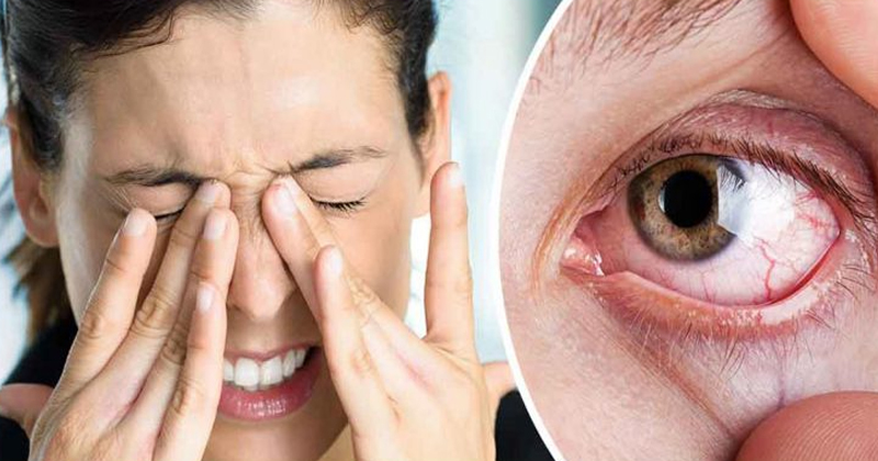 Keep Your Eyes Healthy 
