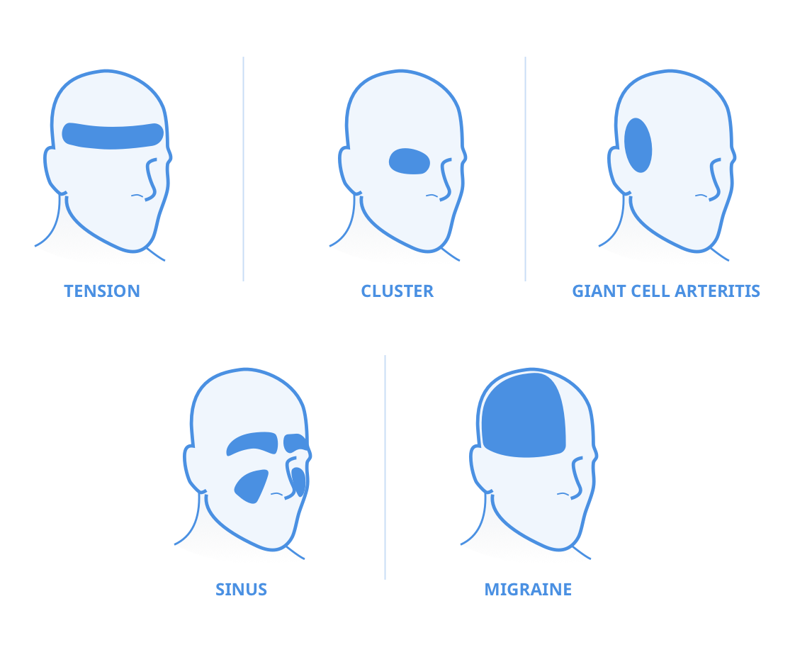 headache types and reasons
