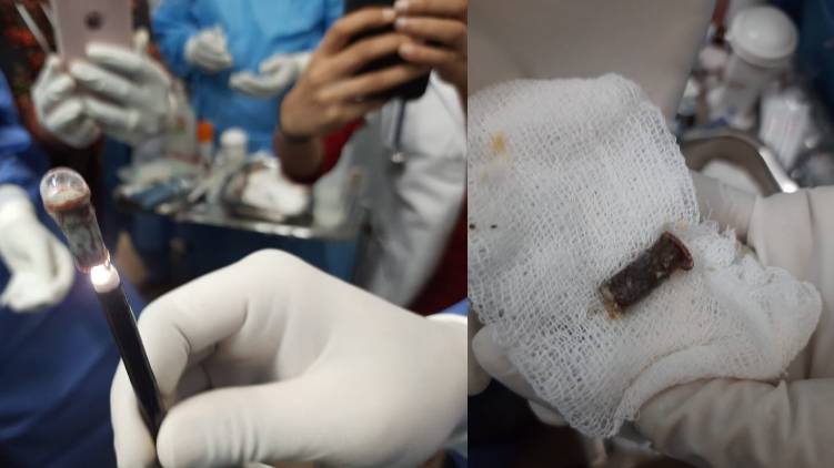 whistle removed by docs