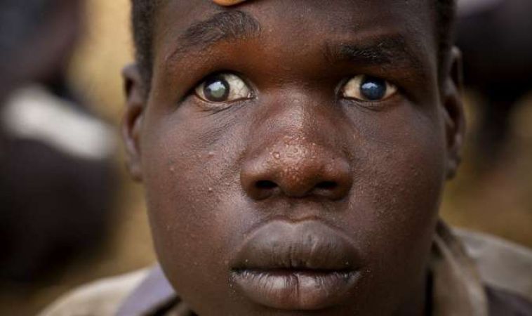 blind village 2