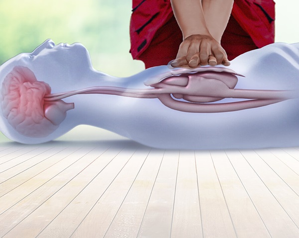 Precautions to be taken during heart stroke