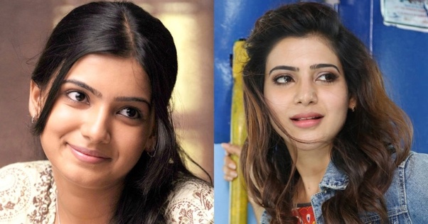 plastic surgery 2