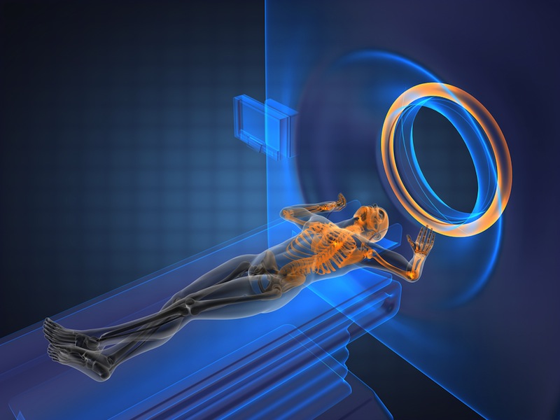 mri scanning 3
