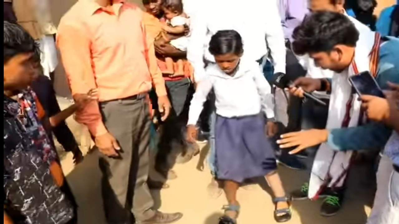Bihar girl artificial leg images