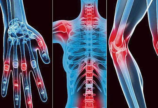 what is myositis..?? netizens shocked to hear about samantha illness..