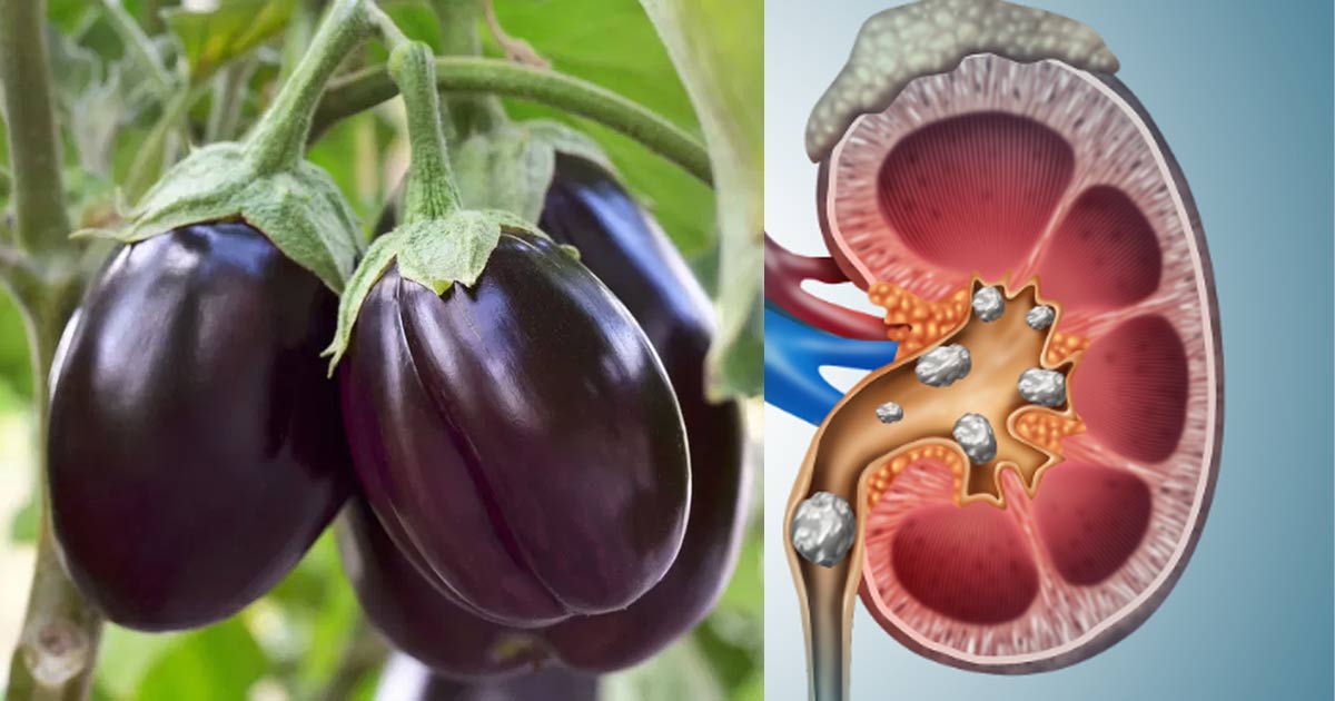 Brinjal-side-effects1